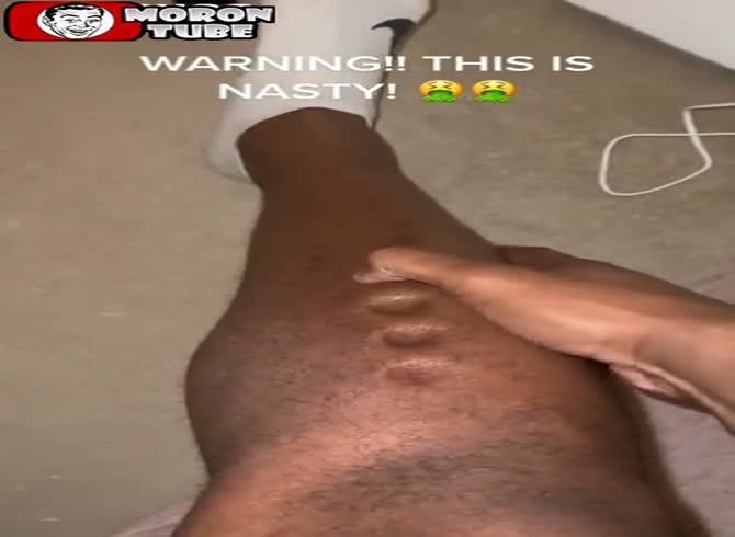 Video :He takes pride in displaying the peculiar reactions of his skin